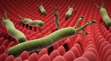 جرثومة المعدة تؤثر على نصف سكان بعض الدول.. 7 أعراض رئيسية وطريقة علاج فعالة 1